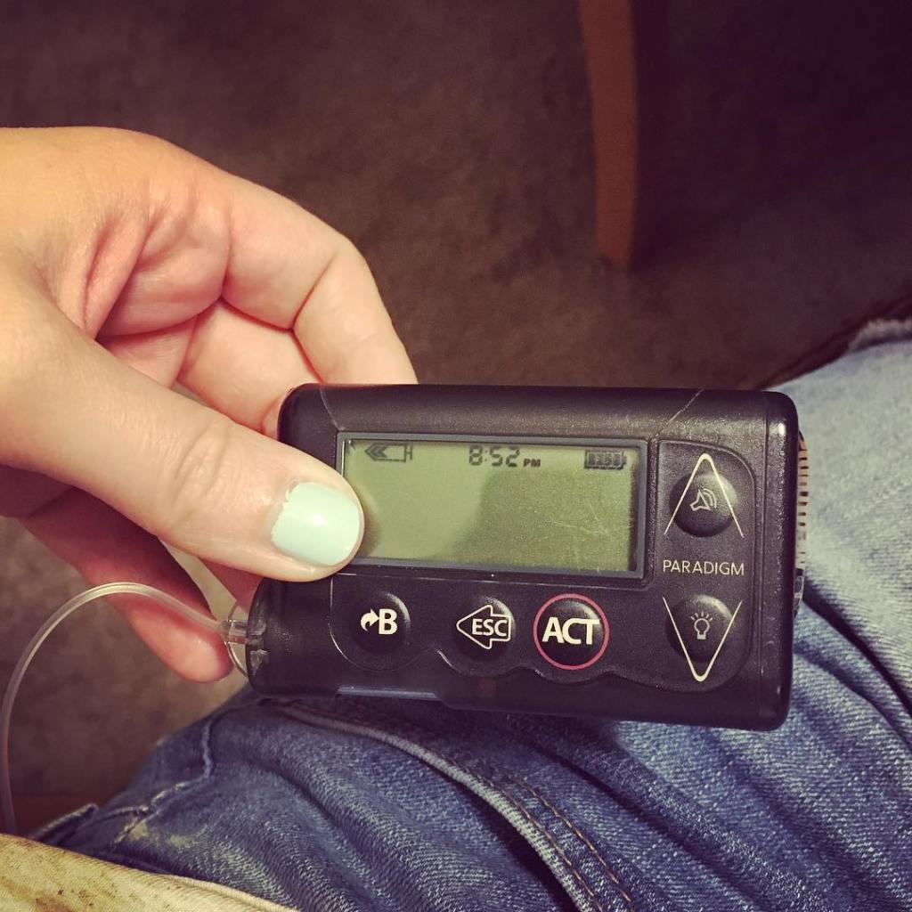 insulin pump
